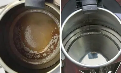 Ấm đun nước bám đầy cặn bẩn ố vàng: Cho 1 thứ này vào đun xôi là sạch bong, sáng bóng như mới mua