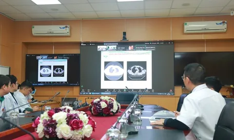 Vụ xe khách va chạm xe đầu kéo tại Sơn La: Hội chẩn khẩn cấp từ xa, cấp cứu bệnh nhân