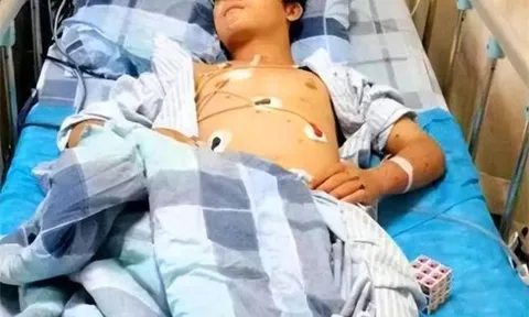 Nam sinh 17 tuổi suy thận giai đoạn cuối vì nghiện 2 món “ngon không cưỡng nổi”