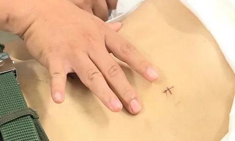 Nghiện game và lối sống thất thường, chàng trai 19 tuổi suýt mất mạng vì loét dạ dày