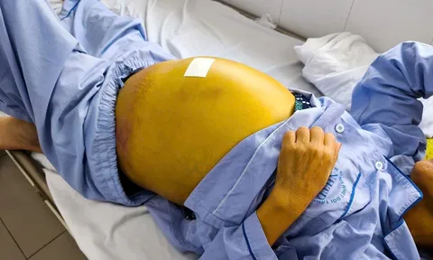 Da vàng như nghệ, đau chân, đi khám bất ngờ phát hiện... viêm gan B giai đoạn cuối