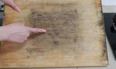 Chuyên gia cảnh báo: Thấy 4 dấu hiệu này trên thớt, hãy thay ngay kẻo rước bệnh vào người