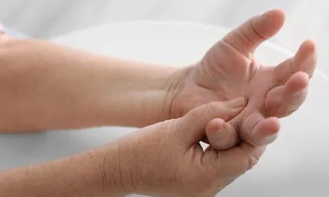 Chủ quan với dấu hiệu tê tay, người phụ nữ ngã quỵ ngay sau khi thức dậy