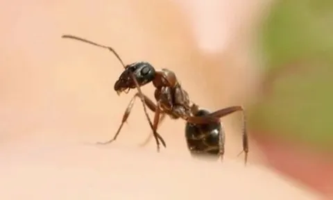 Chủ quan sau khi bị kiến đốt, người đàn ông nguy kịch vì sốc phản vệ