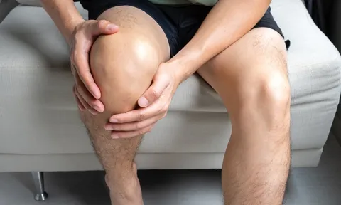 Đầu gối sưng như bánh bao, nam thanh niên sốc khi biết nguyên nhân từ thức uống quen thuộc