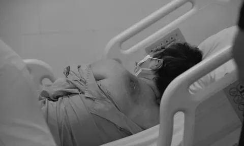 Tin lời “lấy độc trị độc”, người phụ nữ nguy kịch vì uống nước đường chữa tiểu đường