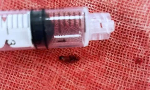 Suýt mất mạng vì vợ chích lể ngón tay chữa đột quỵ theo mạng xã hội