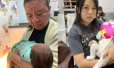 Từ gương mặt xinh đẹp đến làn da sưng đỏ, mũi to, mặt biến dạng: Hành trình mang thai gây sốt của bà mẹ trẻ Malaysia