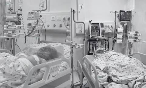 Vụ 2 cháu bé bị cha ruột tưới xăng phóng hỏa: Vợ chồng đã ly hôn, các con đang ở với mẹ