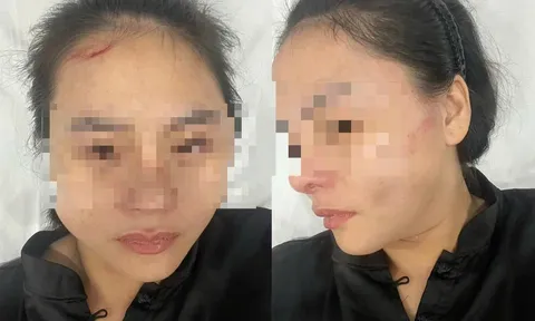 Nữ chủ quán bún riêu hoảng loạn kể lại khoảnh khắc bị chủ nhà khóa cửa, lao vào hành hung