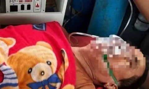 Sử dụng máy phát điện khi bão số 5 tràn qua, hai người dân nguy kịch vì ngạt khí