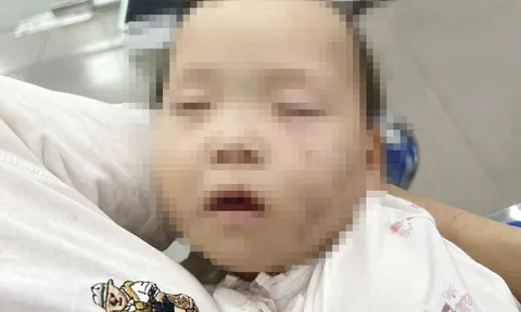 Tạm giữ một giáo viên mầm non có dấu hiệu bạo hành trẻ: Kết quả điều tra ban đầu ra sao?