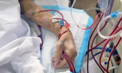 Cô gái 22 tuổi suy thận, ngừng tim sau 4 năm lạm dụng thuốc giảm cân: Bác sĩ tiết lộ lý do nguy hiểm