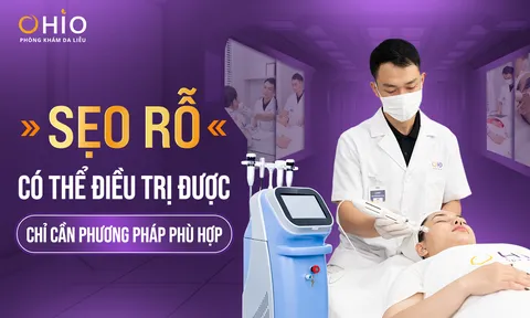Bác sĩ da liễu Nguyễn Thế Anh: “Điều trị sẹo rỗ phải có phác đồ phù hợp và cần dựa trên cơ sở khoa học”