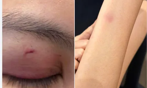 Diễn biến vụ ca sĩ Trung Quân Idol bị tố hành hung bác sĩ: Công an vào cuộc, gia đình nạn nhân yêu cầu xử lý theo quy định pháp luật