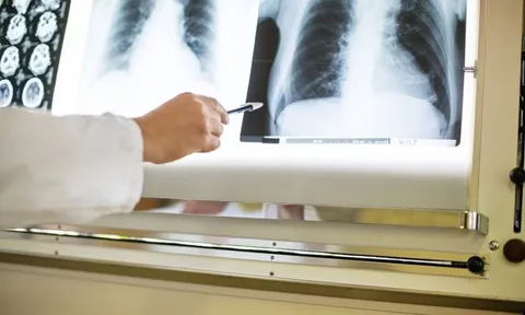 Virus Hanta là gì? Virus Hanta có thuộc danh mục bệnh nghề nghiệp không?