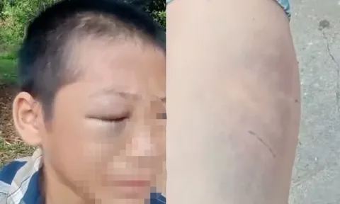 “O ơi cứu cháu với”: Lời cầu cứu xót xa của bé trai nghi bị cha và mẹ kế bạo hành ở Nghệ An