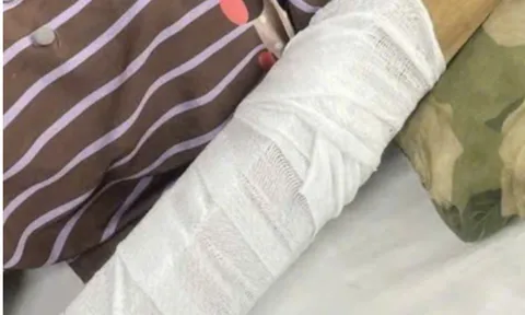 Khoảnh khắc kinh hoàng: Cô gái trẻ bị máy ép nước mía cuốn trọn khi đang bán hàng