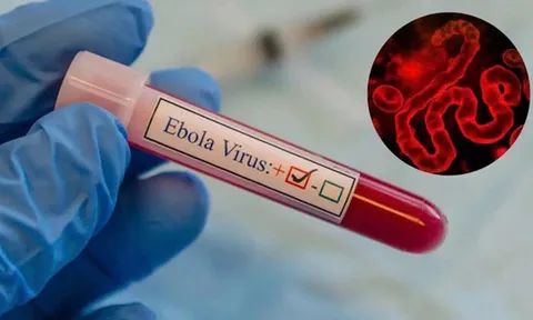 Ebola diễn biến phức tạp, tử vong lên đến 90%: Việt Nam siết phòng dịch