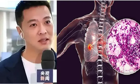 Nam MC điển trai qua đời chỉ sau 15 ngày phát hiện ung thư: Bác sĩ cảnh báo "đừng xem nhẹ cơn ho kéo dài"