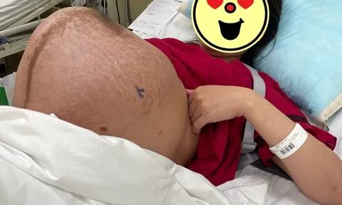 Chiếc bụng mang thai đôi chằng chịt vết rạn, ai nhìn cũng xót xa: “thở thôi cũng mệt”