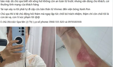 Nghe tiếng “đoàng” trong lúc xông hơi, người phụ nữ 44 tuổi bị bỏng nhiều vùng cơ thể