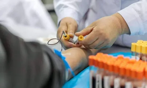 Bác sĩ nhắc nhở: Nếu cánh tay xuất hiện 4 dấu hiệu này, đừng chần chừ đi khám