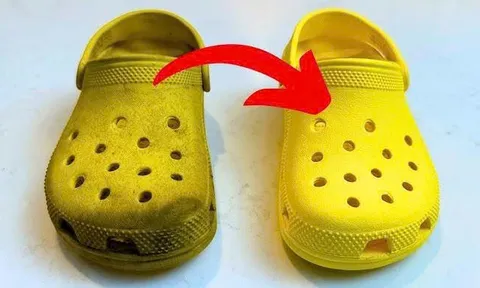 Cách vệ sinh dép Crocs nhanh chóng, đơn giản sạch bong như mới