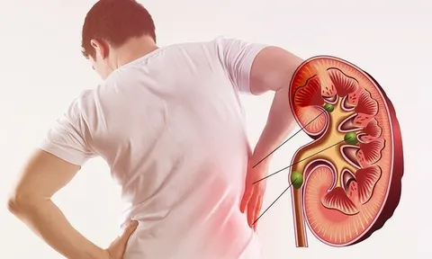 5 chỉ dấu nhận biết chức năng thận của bạn đang duy trì ổn định
