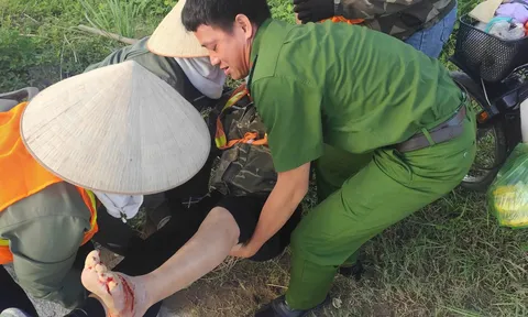 Người phụ nữ nằm gục bên đường sau tai nạn, được cán bộ công an hỗ trợ đưa đi cấp cứu