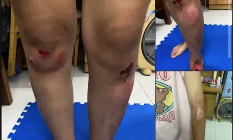 Nhóm 8 thanh niên đi 4 xe máy chặn đánh hai cô gái ở Hà Nội, công an vào cuộc