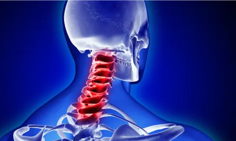 Những lưu ý "sinh tử" trước khi tự ý thực hiện kéo giãn cột sống cổ mọi người cần biết