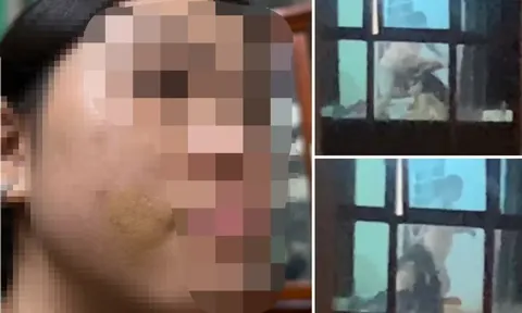 Diễn biến vụ bé gái bị mẹ kế bạo hành ở Phú Thọ, xót xa lời kể về những lần bị đánh