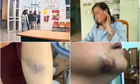 Nữ y sĩ bị 3 người đàn ông đánh hội đồng: Hỏi vì sao chửi bác sĩ là chó mèo thì bị đánh hội đồng