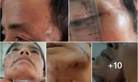 Vụ bắt giữ người vì nghi bị bỏ bùa ở Điện Biên: Chính quyền nói gì?