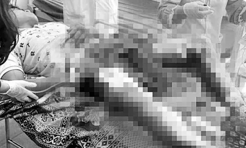 Hiện trường xót xa và ám ảnh khi người đàn ông bị bỏng nặng vùng kín nằm bất tỉnh ven đường