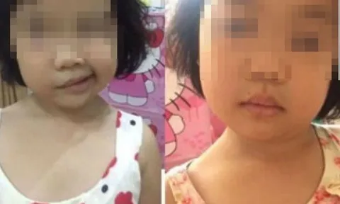 Con gái 4 tuổi méo miệng khi vừa ngủ dậy, mẹ tưởng bị đột quỵ hóa ra do sai lầm khi dùng điều hòa