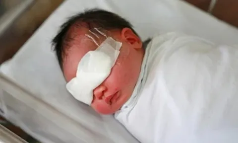 Một bé trai 2 tuổi mất thị lực mắt trái vì hành động này của người thân
