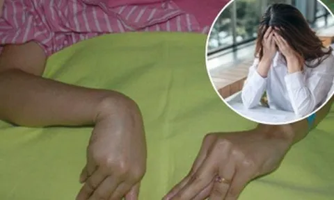 Xung đột căng thẳng với chồng, người phụ nữ co quắp chân tay phải nhập viện