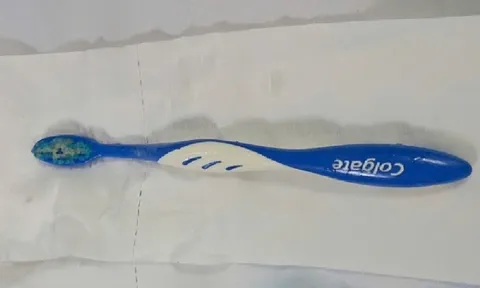 Hy hữu: Người phụ nữ nuốt bàn chải đánh răng dài 17cm vào thực quản