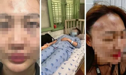 Vụ thanh niên "bắt cá hai tay", đánh bạn gái bất tỉnh ở quán cà phê: Tình tiết mới nhất