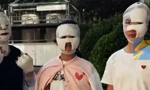 Bữa nướng thịt biến thành thảm kịch sau tiếng nổ từ bếp gas, 7 người bị thương