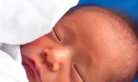 Con chào đời 1 tuần vẫn chưa mở mắt, bố mẹ vội vã đưa đến bệnh viện, bác sĩ bật cười