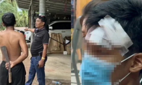 Một nam shipper bị chồng khách hàng nữ tấn công phải khâu 24 mũi khi đến nhà lấy tiền hàng