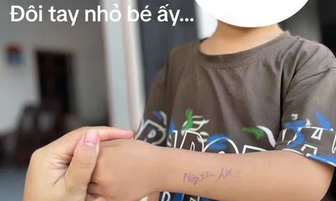 Dòng chữ kém duyên trên cánh tay học sinh mầm non do cô giáo viết khiến gia đình tức giận, mẹ Việt tranh cãi