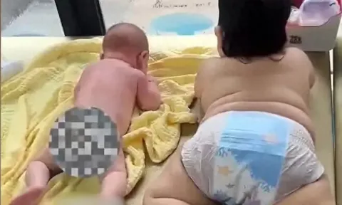 Bé trai 5 tháng tuổi đã to gấp đôi người anh 7 tháng, kết luận của bác sĩ khiến mẹ bỉm hối hận