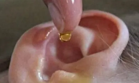 Con gái mẫu giáo bị sinh vật lạ chui vào tai, chỉ với một hành động người mẹ được bác sĩ khen “Rất thông minh”