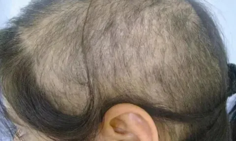 Con gái 3 tuổi rụng gần hết tóc, mẹ đưa đến bệnh viện, bác sĩ nói “Hãy báo cảnh sát”