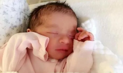 Bé trai sinh ra có đôi tai “biến dạng”, gia đình lo lắng đưa đến bệnh viện, nghe bác sĩ nói người mẹ bật khóc
