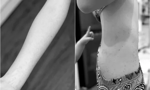 Mẹ Hà Nội bức xúc vì chi gần 20 triệu đồng cho con đi trại hè nhưng con bị bắt nạt, nhịn 8 ngày không đi vệ sinh